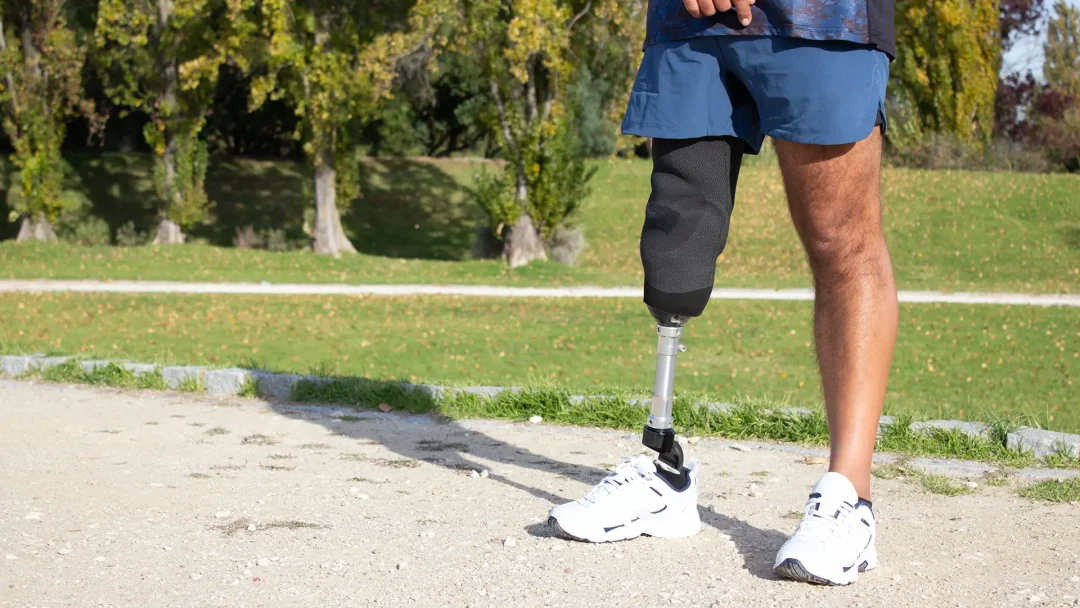 close-up-caucasian-man-with-mechanical-leg-sportsman-blue-shorts-white-sneakers-photographed-park-sport-disability-concept